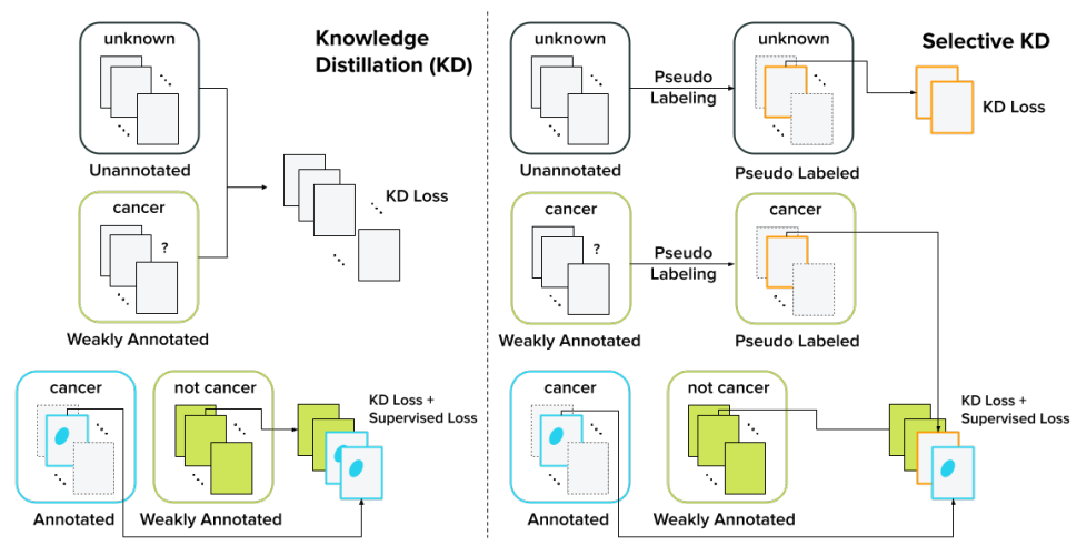 SelectiveKD: A semi-supervised framework for cancer detection in DBT through Knowledge Distillation and Pseudo-labeling